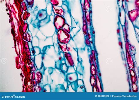 Plant Tissues Under the Microscope in the Laboratory. Stock Photo - Image of tube, vascular ...