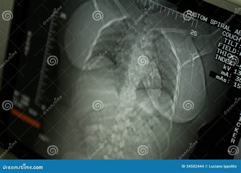 Abdomen MRI Or CT Image Stock Photography | CartoonDealer.com #34502444