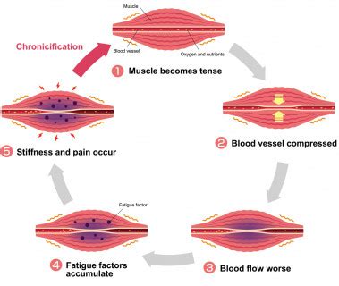 Muscle fatigue: the cause doctors usually overlook- and what you can do about it | Muscle ...