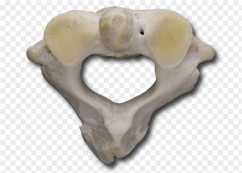 Cervical Vertebra Atlas Anatomy Bone Snout Vertebral Column PNG Image ...