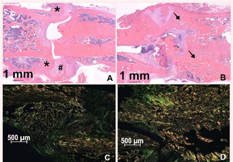 Histologic section of the bone callus 28 days after fracture. A-The ...