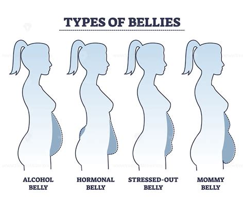 Types of bellies with abdominal fat problem in stomach area outline ...