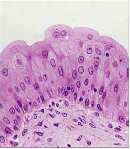 transitional epithelium in bladder | Tissue biology, Biology art ...