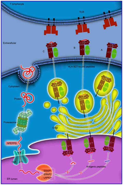 Role of HLA-B27 in the pathogenesis of ankylosing spondylitis (Review)