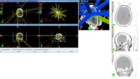 Cancer Therapy Centres » Radiation Oncology