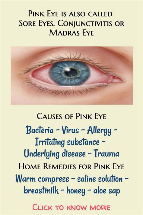 Pink eye is a common eye problem. This hub discusses the causes of pink eye as well as some home ...