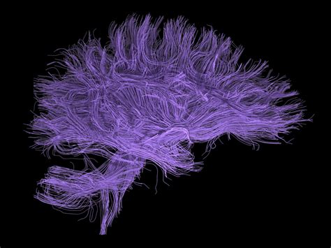 Brain Art Competition 2011 | The Neuro Bureau
