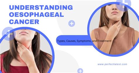 Perfect latest on LinkedIn: “Understanding Oesophageal Cancer: 3 Types ...