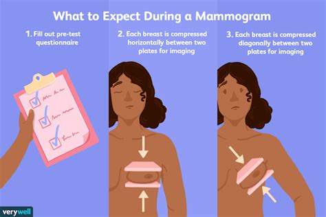 Mammogram: Uses, Side Effects, Procedure, Results