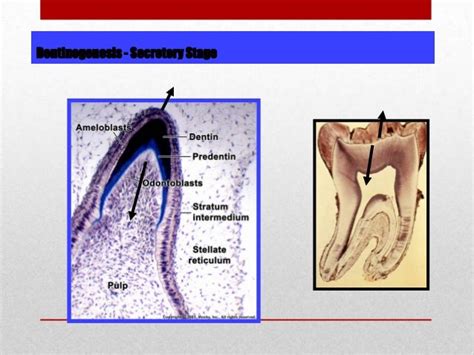 dentin pattern of mineralization, 1ry 2nd 3ry dentin formation and ro…