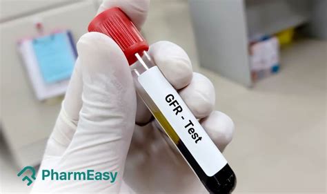 Glomerular Filtration Rate Test - PharmEasy Blog