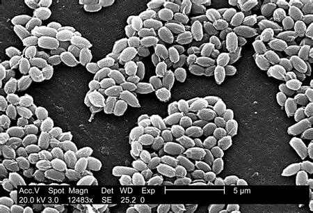 Bacterial Endospores | Definition, Development & Function - Lesson | Study.com