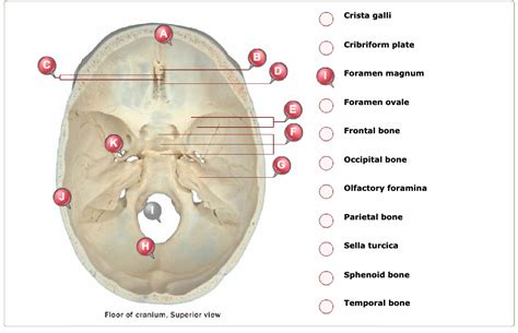 Crista Galli And Cribriform Plate