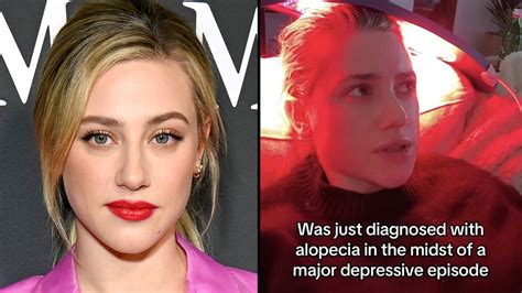 Lili Reinhart shares she has been diagnosed with alopecia - Capital