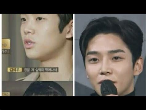 ROWOON SF9 PLASTIC SURGERY - YouTube