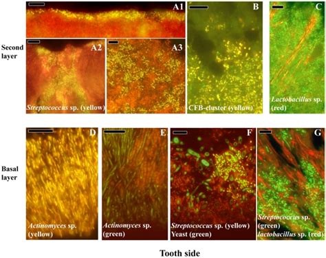 Streptococcus sp. (yellow) form a thin band on top of the biofilm (A1 ...