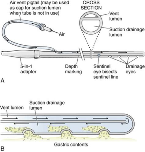 Ng suction tube