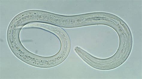 Hookworm Infections: Causes, Symptoms, and Treatments