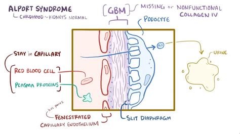 Alport syndrome: Video, Anatomy, Definition & Function | Osmosis