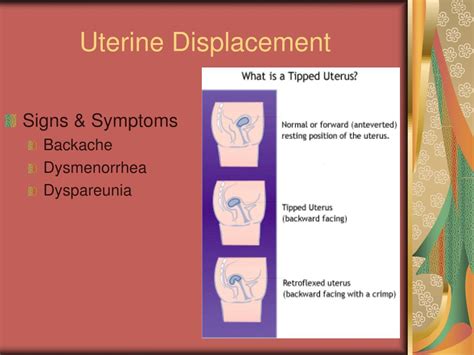 PPT - FEMALE REPRODUCTIVE DISORDERS Chapters 39 &40 PowerPoint ...