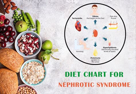 Diet Chart For Nephrotic Syndrome - Food to Take / Food to Avoid