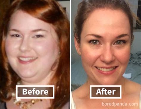 128 Surprising Photos of Face Fat Loss Before and After Weight Loss ...