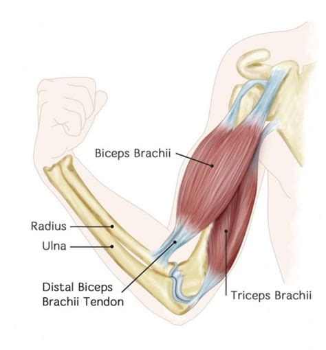 Distal Bicep Tendon Pain