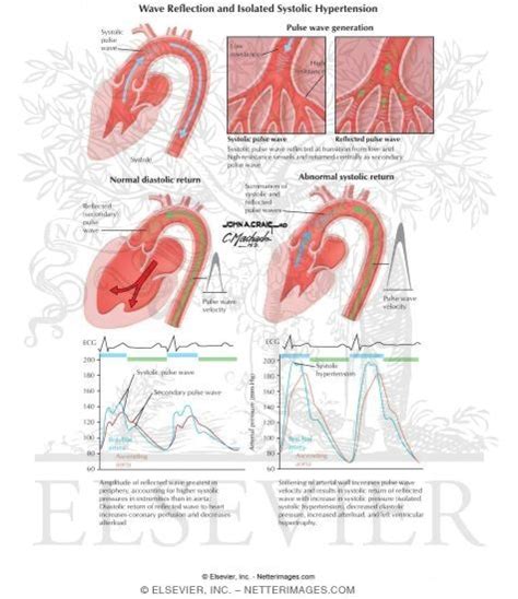 Wave Reflection and Isolated Systolic Hypertension