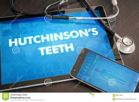 Hutchinson S Teeth (cutaneous Disease) Diagnosis Medical Concept Stock ...