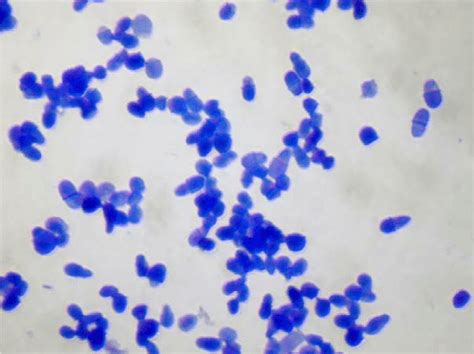 Microscopic image of a Malassezia spp. culture. Methylene blue staining ...