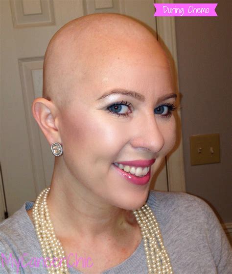 What to Expect During Chemo: 12 Tips from a Survivor | | Chemo hair ...