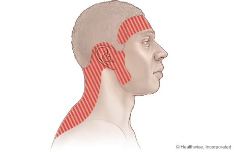 Tension Headache | UK Healthcare