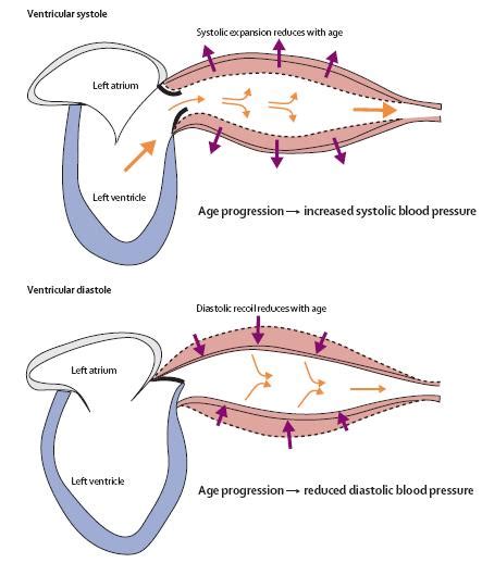 isolated systolic hypertension | Dr.S.Venkatesan MD