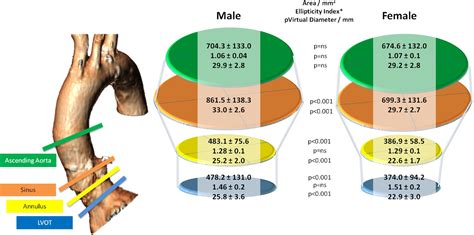 Aortic Root Dimensions Among Patients With Severe Aortic Stenosis Undergoing Transcatheter ...