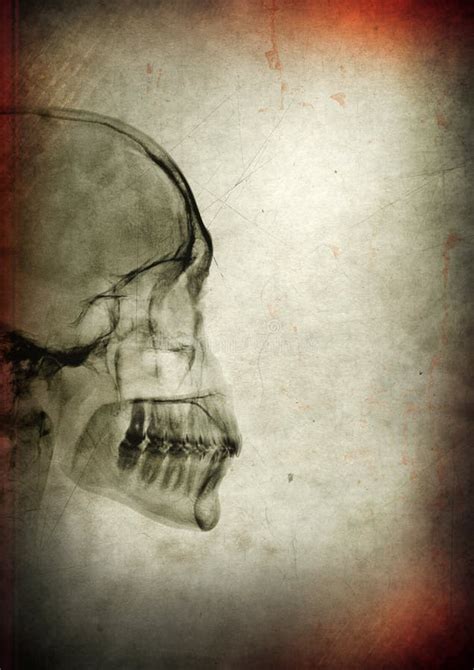 X-ray Skull on a Dark Textured Background Stock Image - Image of background, thriller: 152328011