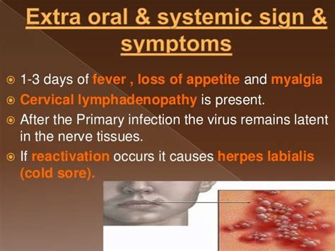 Primary herpetic gingivostomatitis