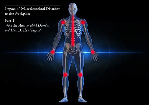 What are Musculoskeletal Disorders and How Do They Happen?