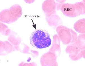 Monocytes High Levels, Causes