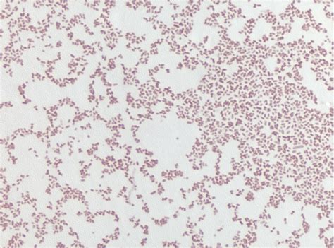 Enterobacter Aerogenes Gram Stain