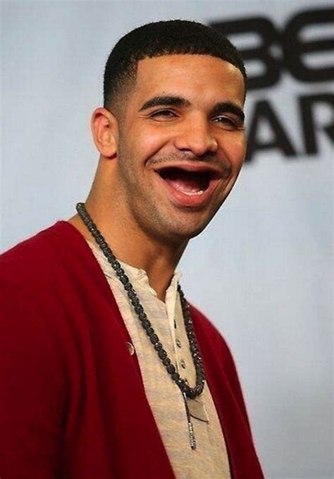 Drake. | 22 Celebrities Without Teeth HOLY CRAP! FUNNY Can't Stop ...