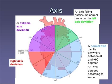 Determining Right or Left Axis Deviation | Basic anatomy and physiology ...