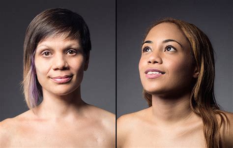 4 Women Show the Reality of Their Mastectomies in Stunning Photos ...