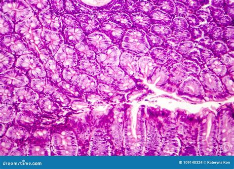 Histology of Human Appendix, Micrograph Showing Crypts of Lieberkuhn Stock Photo - Image of ...