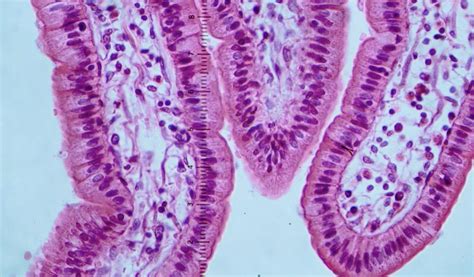 Simple Columnar | Human tissue, Tissue types, Cells and tissues