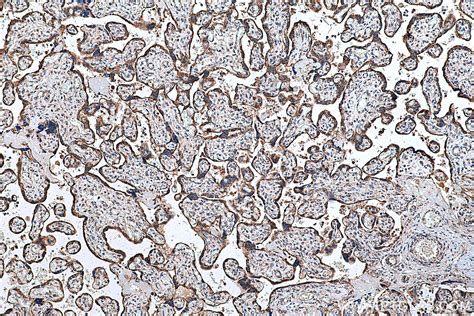 FH antibody (11375-1-AP) | Proteintech