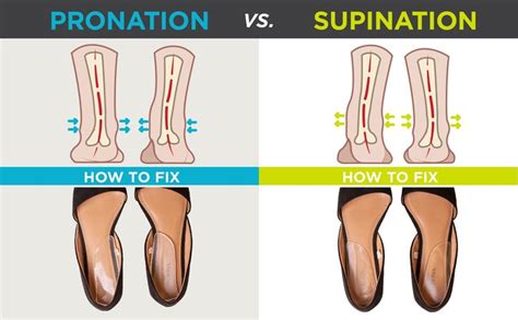 graphic showing the difference between supination and over pronation ...