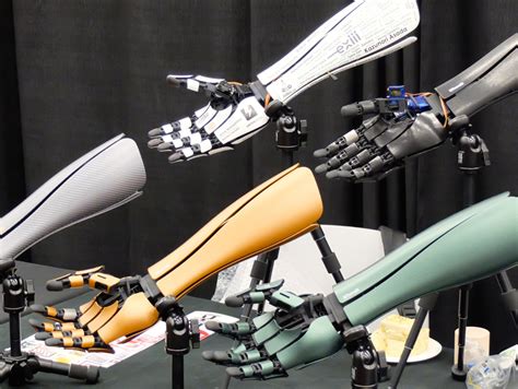 This robotic arm is part prosthetic, part fashion statement