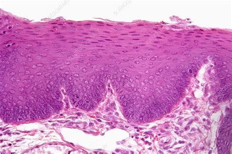 Stratified squamous epithelium. LM - Stock Image - C005/5901 - Science Photo Library