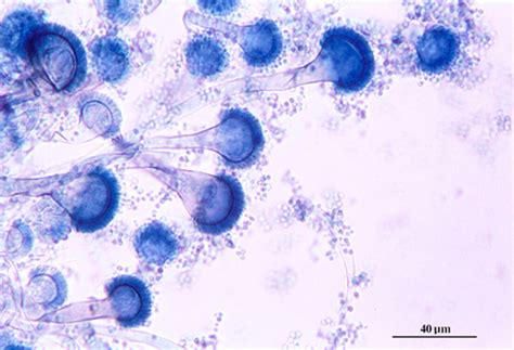 MBBS Medicine (Humanity First): Microscopic morphology of Aspergillus