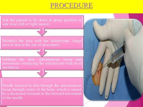 Bone marrow aspiration & trephine biopsy